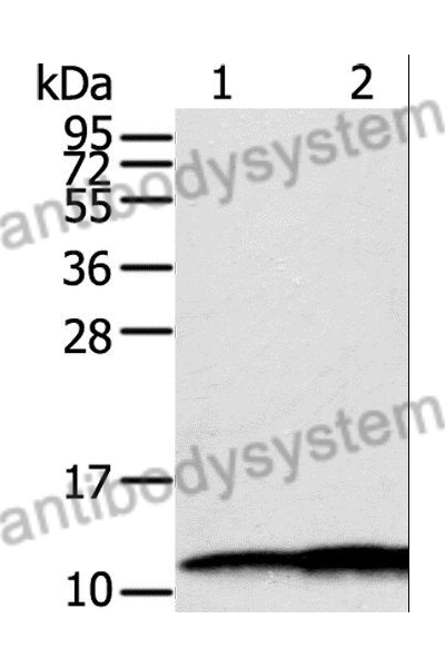 Anti-S100A11 Polyclonal Antibody