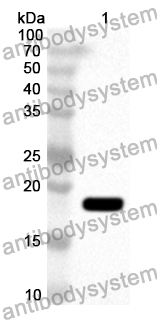 Anti-CD171/L1CAM Polyclonal Antibody