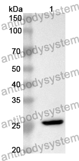 Anti-CD171/L1CAM Polyclonal Antibody