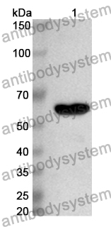 Anti-Human GK Polyclonal Antibody