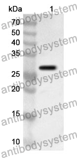 Anti-CD191/CCR1 Polyclonal Antibody