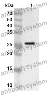 Anti-CHRNA3 Polyclonal Antibody