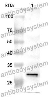 Anti-CHRNA3 Polyclonal Antibody