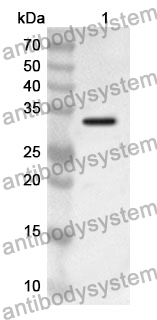 Anti-GRK4 Polyclonal Antibody