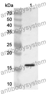 Anti-CDA Polyclonal Antibody