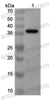 Anti-Human SLC8A1 Polyclonal Antibody