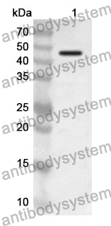 Anti-HPD Polyclonal Antibody