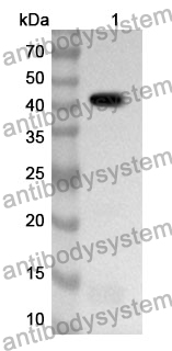 Anti-DSG3 Polyclonal Antibody