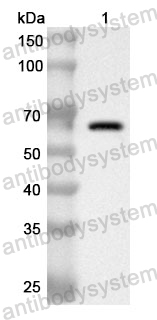 Anti-Human DSG3 Polyclonal Antibody