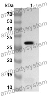 Anti-CTH Polyclonal Antibody