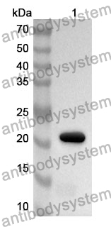 Anti-Human CD153/TNFSF8 Polyclonal Antibody