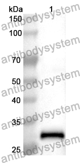 Anti-ACSL1 Polyclonal Antibody