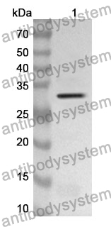 Anti-TTK Polyclonal Antibody