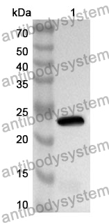 Anti-MCM5 Polyclonal Antibody