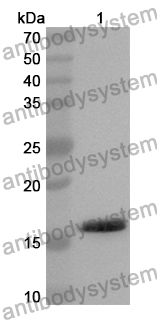 Anti-RNASE4 Polyclonal Antibody