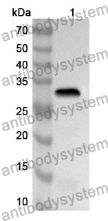 Anti-RYK Polyclonal Antibody