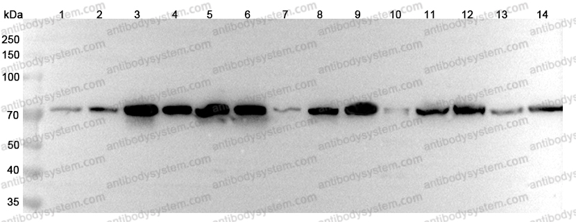 Anti-HSPA1L Polyclonal Antibody