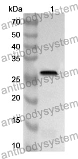 Anti-HSPA4 Polyclonal Antibody