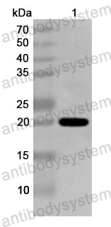 Anti-Human HTR7 Polyclonal Antibody