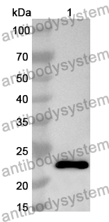 Anti-Human CRHR1 Polyclonal Antibody