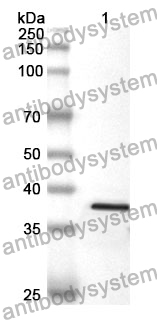 Anti-GPC1 Polyclonal Antibody