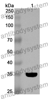 Anti-CA8 Polyclonal Antibody