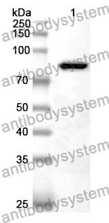 Anti-CTNNB1 Polyclonal Antibody