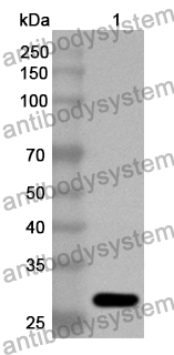 Anti-NF2 Polyclonal Antibody