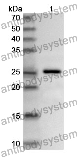 Anti-RCVRN Polyclonal Antibody