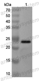 Anti-Human RPL22 Polyclonal Antibody