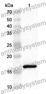 Anti-Human ADM Polyclonal Antibody