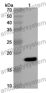 Anti-ADRA1A Polyclonal Antibody