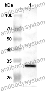 Anti-Human PTGER4/EP4 Receptor Polyclonal Antibody