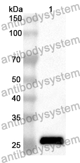 Anti-THBS2 Polyclonal Antibody