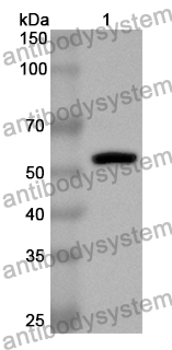 Anti-Human CBS Polyclonal Antibody