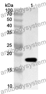 Anti-Human KRT9 Polyclonal Antibody