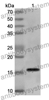 Anti-FBN1/Fibrillin-1 Polyclonal Antibody