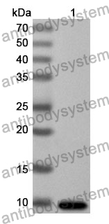 Anti-FBN1 Polyclonal Antibody