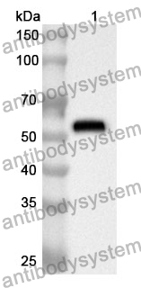 Anti-Human GCK Polyclonal Antibody