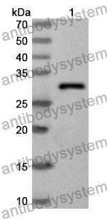 Anti-PCK1 Polyclonal Antibody