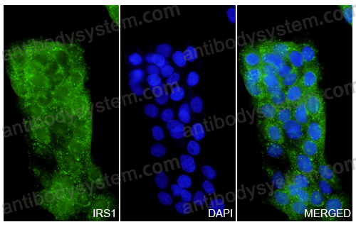 Anti-IRS1 Polyclonal Antibody