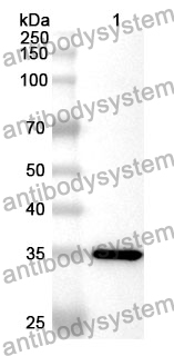 Anti-MYH10 Polyclonal Antibody