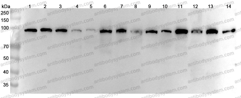 Anti-Human ACTN2 Polyclonal Antibody