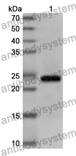 Anti-TIMP3 Polyclonal Antibody