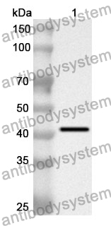 Anti-ATP7B Polyclonal Antibody