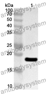 Anti-HNF1B Polyclonal Antibody