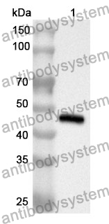 Anti-Human MYH11 Polyclonal Antibody