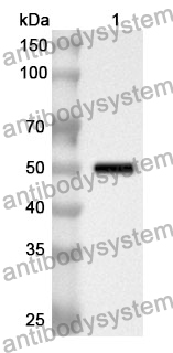 Anti-KRT20 Polyclonal Antibody