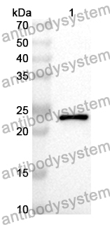 Anti-Human PDE6B Polyclonal Antibody