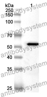 Anti-PSMC2 Polyclonal Antibody